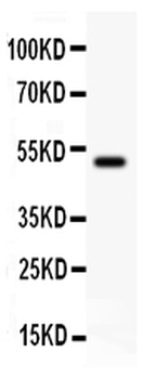 Anti-KAT3B/p300/EP300 Antibody