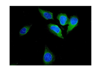 Anti-FHIT Antibody