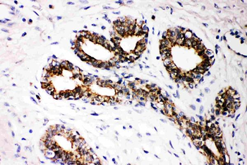 Anti-FHIT Antibody