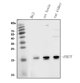 Anti-FHIT Antibody