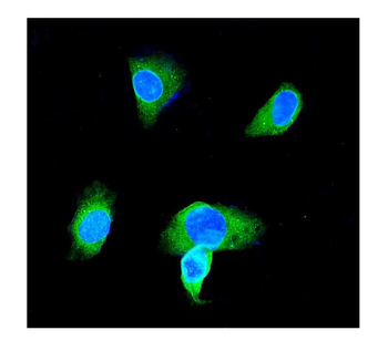 Anti-GST3/GST pi/GSTP1 Antibody