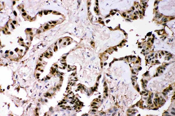 Anti-GST3/GST pi/GSTP1 Antibody