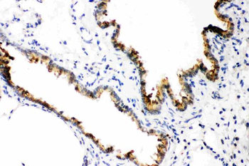 Anti-GST3/GST pi/GSTP1 Antibody