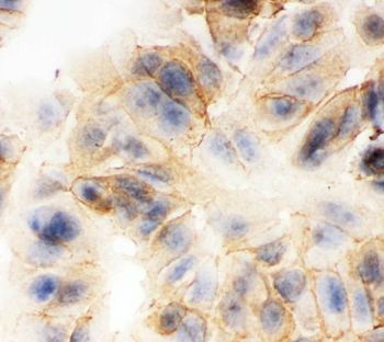 Anti-gamma Catenin/JUP Antibody