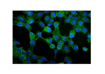 Anti-gamma Catenin/JUP Antibody