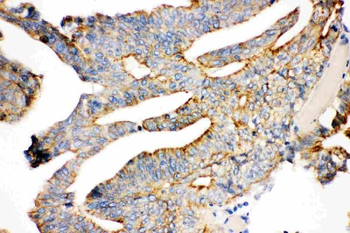 Anti-gamma Catenin/JUP Antibody