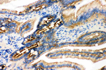 Anti-gamma Catenin/JUP Antibody