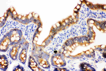 Anti-gamma Catenin/JUP Antibody