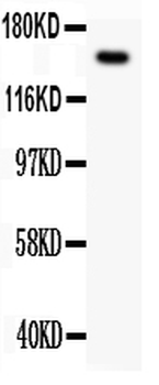 Met Rabbit Polyclonal Antibody
