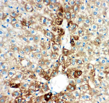 Anti-Cytochrome P450 2E1/CYP2E1 Antibody