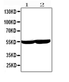 Anti-Cytochrome P450 2E1/CYP2E1 Antibody