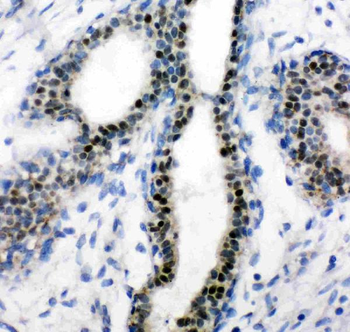Estrogen Receptor/ESR1 Rabbit Polyclonal Antibody