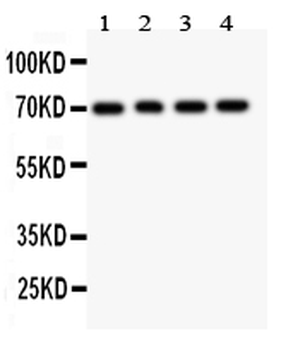 FOXO1A Rabbit Polyclonal Antibody