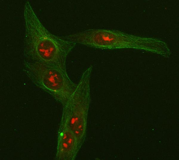 Anti-FOXO3A Antibody