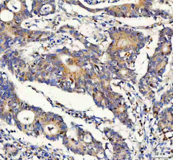 Anti-FOXO3A Antibody