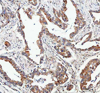 Anti-FOXO3A Antibody
