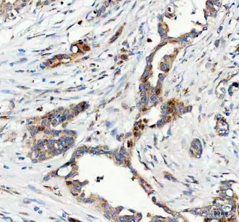 Anti-FOXO3A Antibody