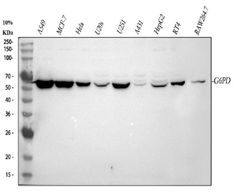 Glucose 6 Phosphate Dehydrogenase/G6PD Rabbit Polyclonal Antibody