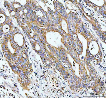 Anti-GCLC Antibody