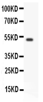 Anti-GDNF Receptor alpha 1/GFRA1 Antibody
