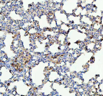 Anti-Glutathione Peroxidase 1/GPX1 Antibody