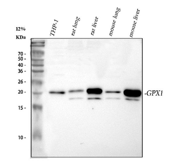 Anti-Glutathione Peroxidase 1/GPX1 Antibody