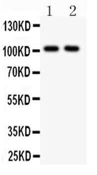 Anti-Glutamate Receptor 1/GRIA1 Antibody
