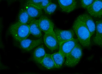 Anti-Ionotropic Glutamate receptor 2/GRIA2 Antibody