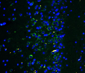 Anti-Ionotropic Glutamate receptor 2/GRIA2 Antibody