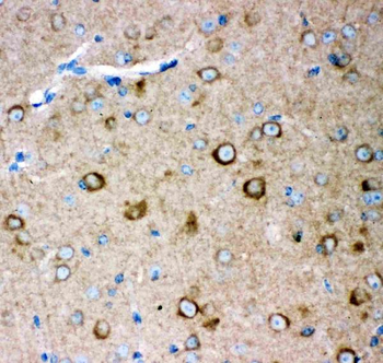 Anti-Ionotropic Glutamate receptor 2/GRIA2 Antibody