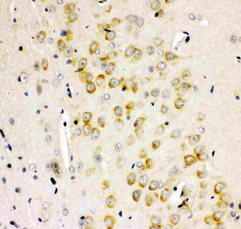 Anti-Ionotropic Glutamate receptor 2/GRIA2 Antibody