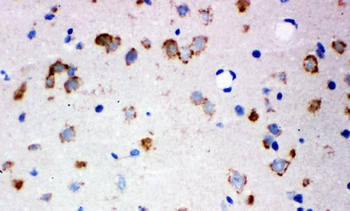 Anti-Ionotropic Glutamate receptor 2/GRIA2 Antibody