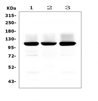 Anti-Ionotropic Glutamate receptor 2/GRIA2 Antibody
