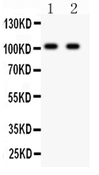 Glutamate receptor 3/GRIA3 Antibody