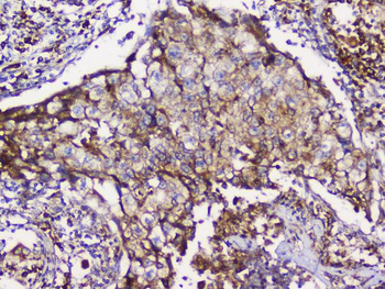 Anti-GRIK1 Antibody