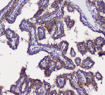 Anti-GRIK1 Antibody