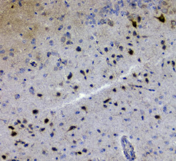 Anti-GRIK1 Antibody