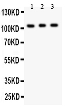 Anti-GRIK1 Antibody