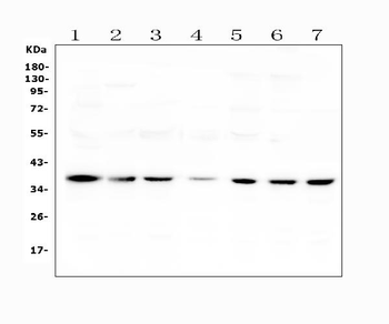 Anti-Heme oxygenase 2/HMOX2 Antibody
