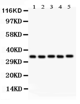 Anti-HOXA11 Antibody