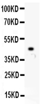 Anti-IKK beta/IKBKB Antibody