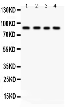 IKK beta/IKBKB Antibody