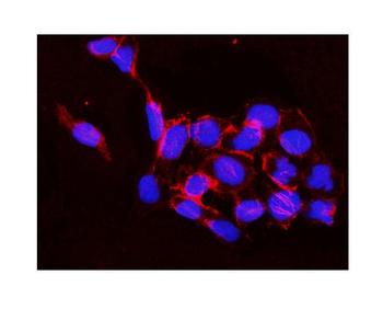 Anti-IKK beta/IKBKB Antibody