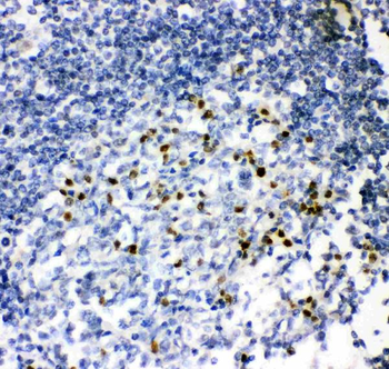 MUM1/IRF4 Rabbit Polyclonal Antibody