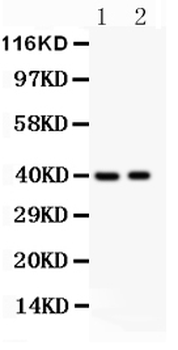 Anti-MUM1/IRF4 Antibody