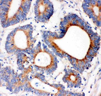 Anti-IRS1 Antibody