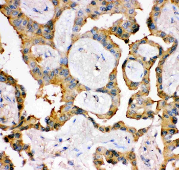 Anti-IRS1 Antibody