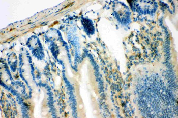 Anti-IRS1 Antibody