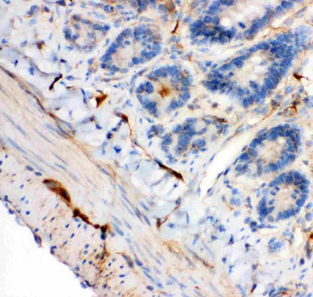 Anti-IRS1 Antibody