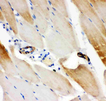Anti-IRS1 Antibody
